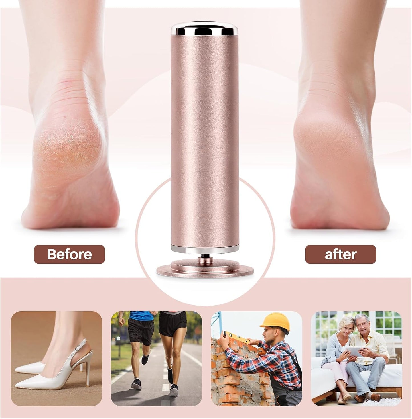 LIONVISON Electric Foot Callus Remover: Adjustable Speed Foot File for Cracked Heels - Working Women's Summer Pedicure Tool with 60pcs Sandpaper Discs - Dead Skin Remover for Dry Feet at-Home