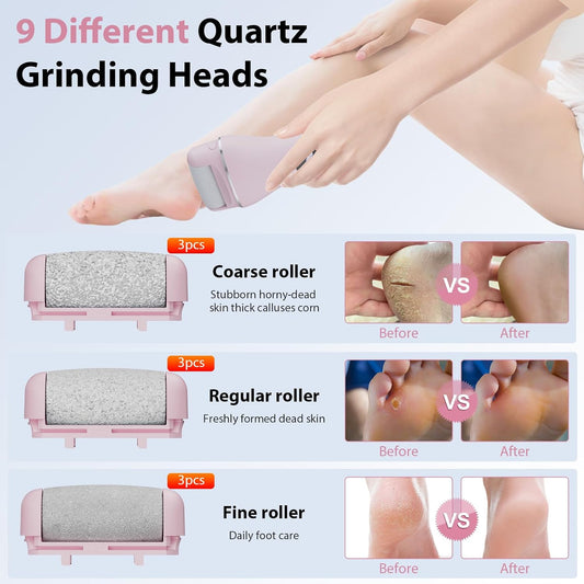 AdamPark Electric Callus Remover for Feet, Rechargeable Portable Electronic Foot Callus Remover 2-in-1 Wet/Dry Foot Scrubber Electric Toot File for Hard Cracked Dry Dead Skin（Pink）