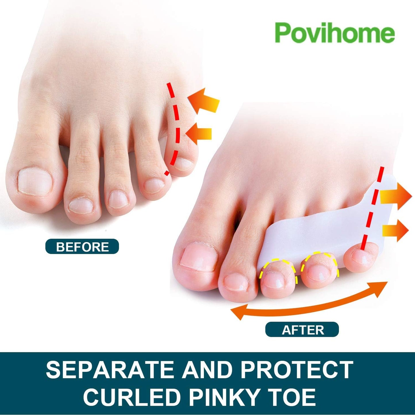 Povihome 10 Pack Pinky Toe Separator and Protectors for Overlapping Toe, Curled Pinky Toes - Spacers for Morton's Neuroma Pain Relief