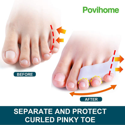 Povihome 10 Pack Pinky Toe Separator and Protectors for Overlapping Toe, Curled Pinky Toes - Spacers for Morton's Neuroma Pain Relief
