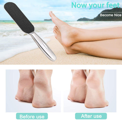 Professional Pedicure Foot File,Coarse/Fine Double Side and Reusable Stainless Steel Cracked Skin Corns Callus Remover Feet Rasp