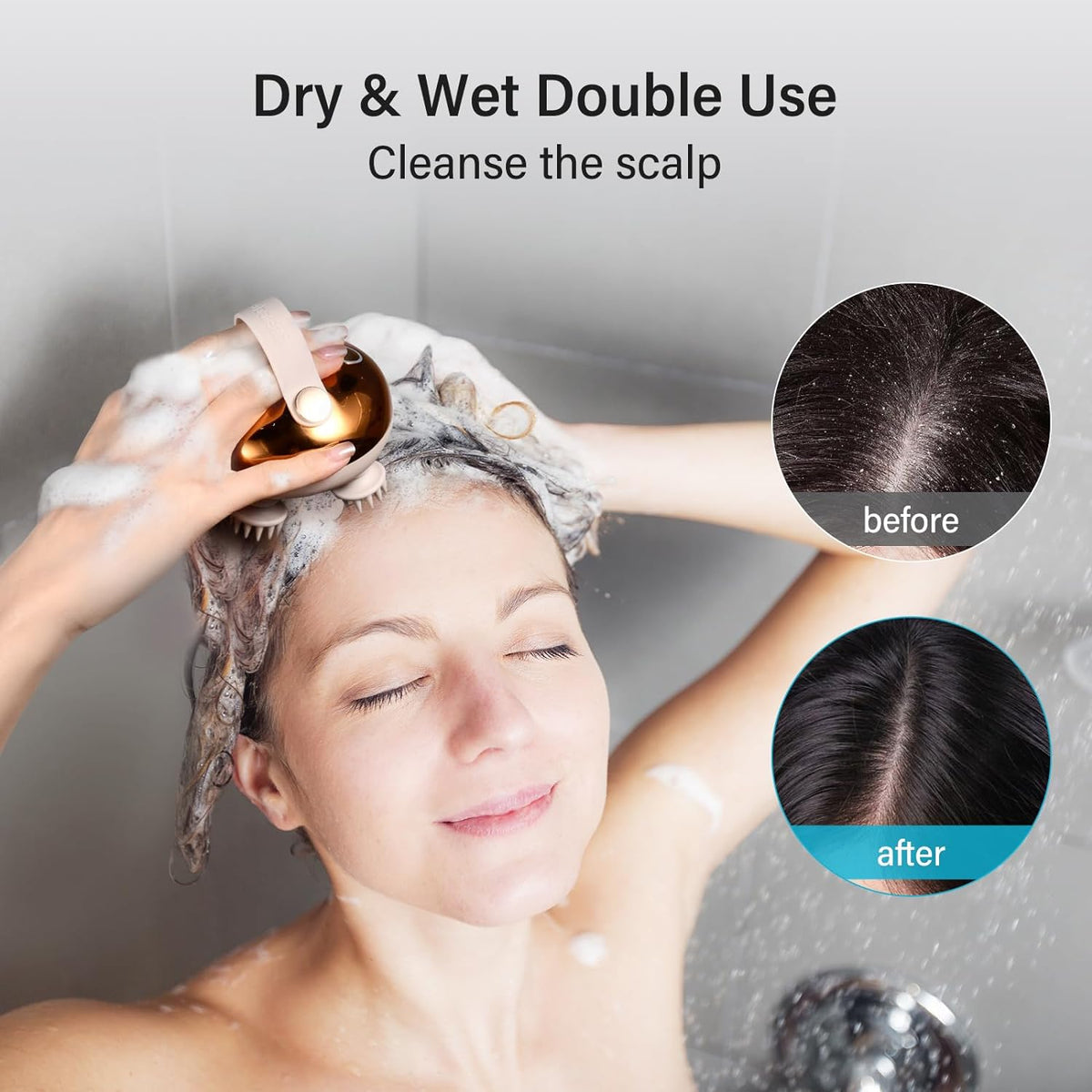 arboleaf Electric Scalp Massager Head Massager Scalp Stress Relax