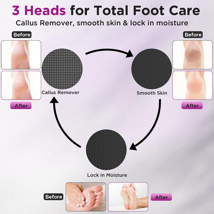 Electric Foot Callus Remover, Apply Oil,Foot File,Reusable Nano-Glass Head, Ergonomic Premium Aluminum Callus Remover for feet, Professional Foot SPA Pedicure Tool at Home