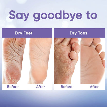CÉLOR Foot Peeling Mask for Dry Cracked Feet | Foot Mask to Exfoliate Rough, Cracked, Dry Feet, Calluses for Soft Baby Feet Results | Made with Aloe Vera Extract for Women & Men (2 Pairs) | Lavender