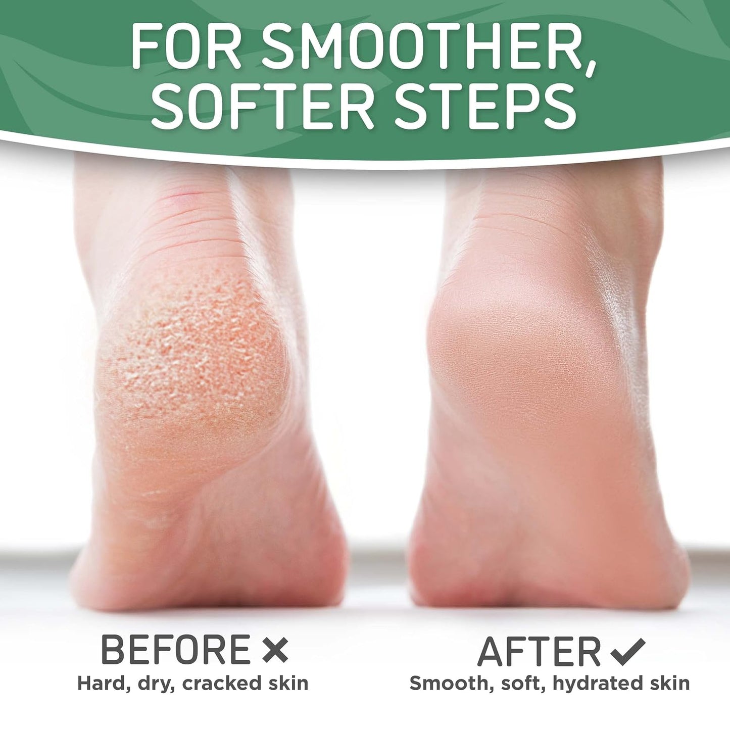 Dermora Soft Touch Foot Peel Mask - Pack of 2 Feet Peeling Masks for Dry, Cracked Heels & Calluses - Exfoliating Foot Mask Peel for Baby Soft Skin (Original)