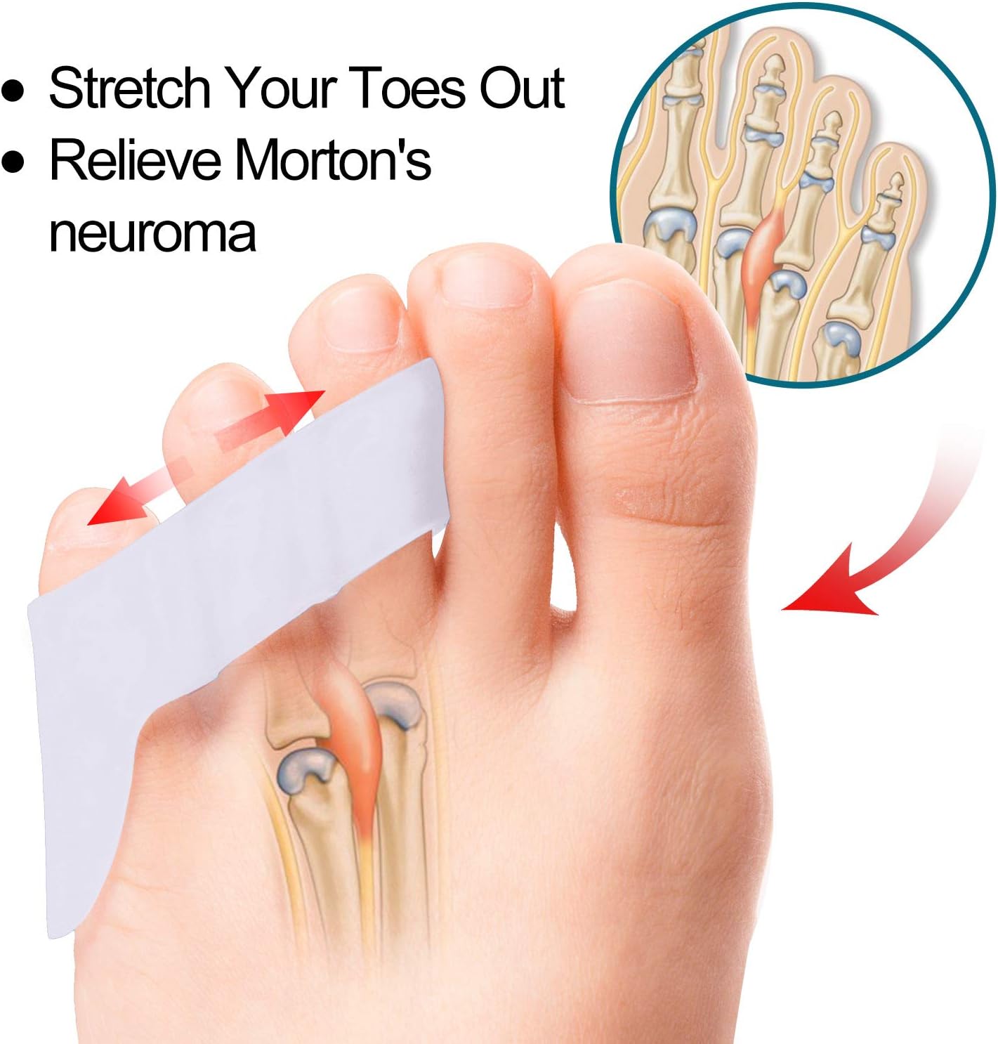 Povihome 10 Pack Pinky Toe Separator and Protectors for Overlapping Toe, Curled Pinky Toes - Spacers for Morton's Neuroma Pain Relief