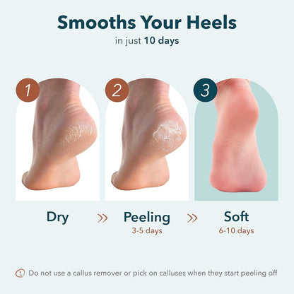 Purederm Exfoliating Foot Peeling Mask & Foot Peel for Dry Cracked Heels (1 Pack) – Dead Skin & Callus Remover for Feet, Rough Skin Care for Baby Soft Feet