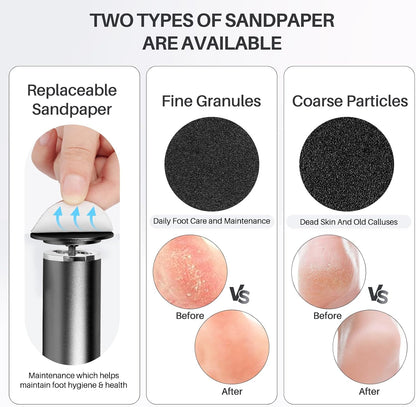LIONVISON Electric Foot Callus Remover: Adjustable Speed Foot File for Cracked Heels - Working Women's Summer Pedicure Tool with 60pcs Sandpaper Discs - Dead Skin Remover for Dry Feet at-Home