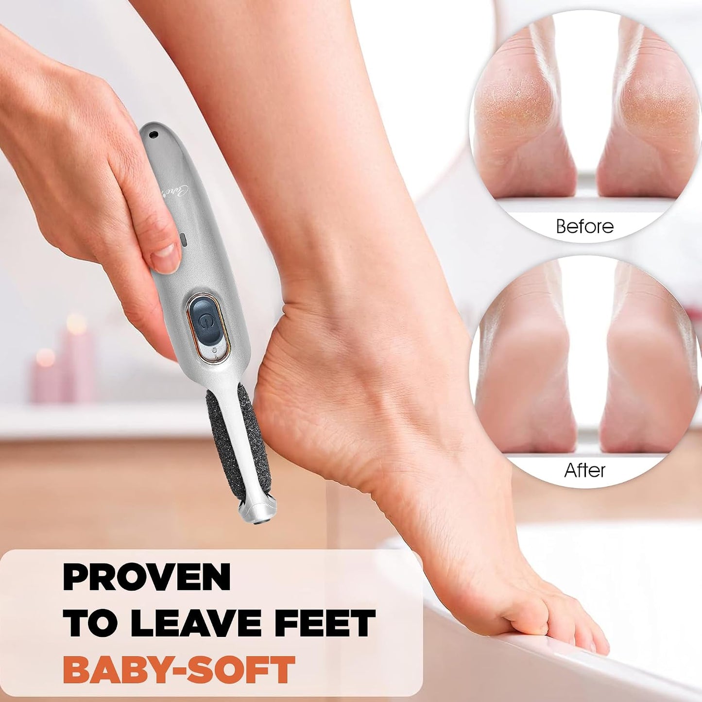 Powerful Electric Callus Remover Wand – Rechargeable Foot File, Grinder & Scrubber - Removes Dead, Hard Skin & Calluses – Best Pedicure Tool for Soft, Smooth Feet for Men & Women (Rose Gold)