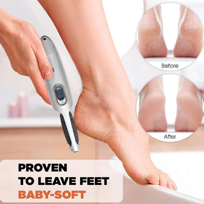 Powerful Electric Callus Remover Wand – Rechargeable Foot File, Grinder & Scrubber - Removes Dead, Hard Skin & Calluses – Best Pedicure Tool for Soft, Smooth Feet for Men & Women (Rose Gold)