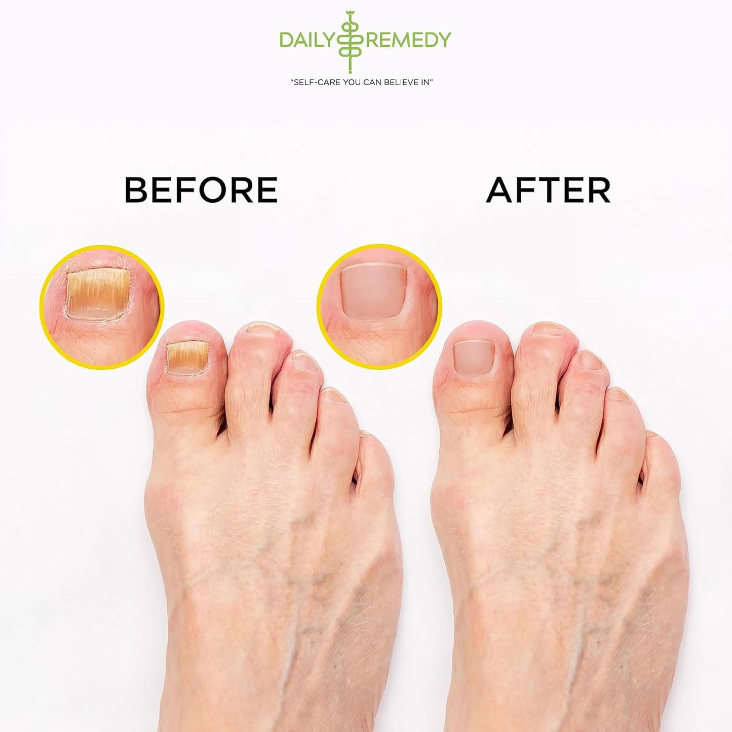 Muscle Relief Foot Soak with Epsom Salt, Made in USA, Soothe Tired Feet, Softens Calluses and Helps Athletes Foot 1lbs