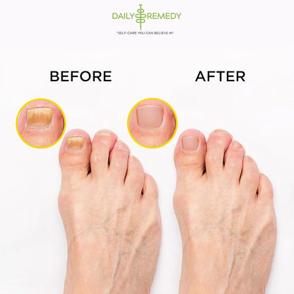 Muscle Relief Foot Soak with Epsom Salt, Made in USA, Soothe Tired Feet, Softens Calluses and Helps Athletes Foot 1lbs