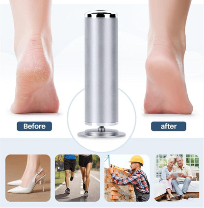 LIONVISON Electric Foot Callus Remover: Adjustable Speed Foot File for Cracked Heels - Working Women's Summer Pedicure Tool with 60pcs Sandpaper Discs - Dead Skin Remover for Dry Feet at-Home