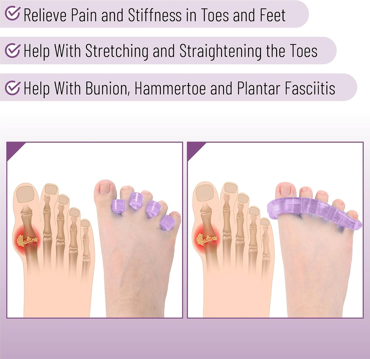 DR. JK- ToePal Gel Toe Separator, 2 Pairs, Toe Spacers, Toe Straightener, Hammer Toe Straightener, Toe Spreader, Toe Stretcher, Toe Corrector for Women and Men, Bunion Corrector