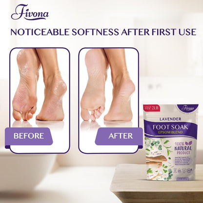 Fivona Tea Tree Foot Soak Blend 14.1 oz - Epsom Salt with Essential Oils for Healthy Toenails, Soothing Relief, Callus Softening - Pedicure Therapy for Soft, Rejuvenated Feet
