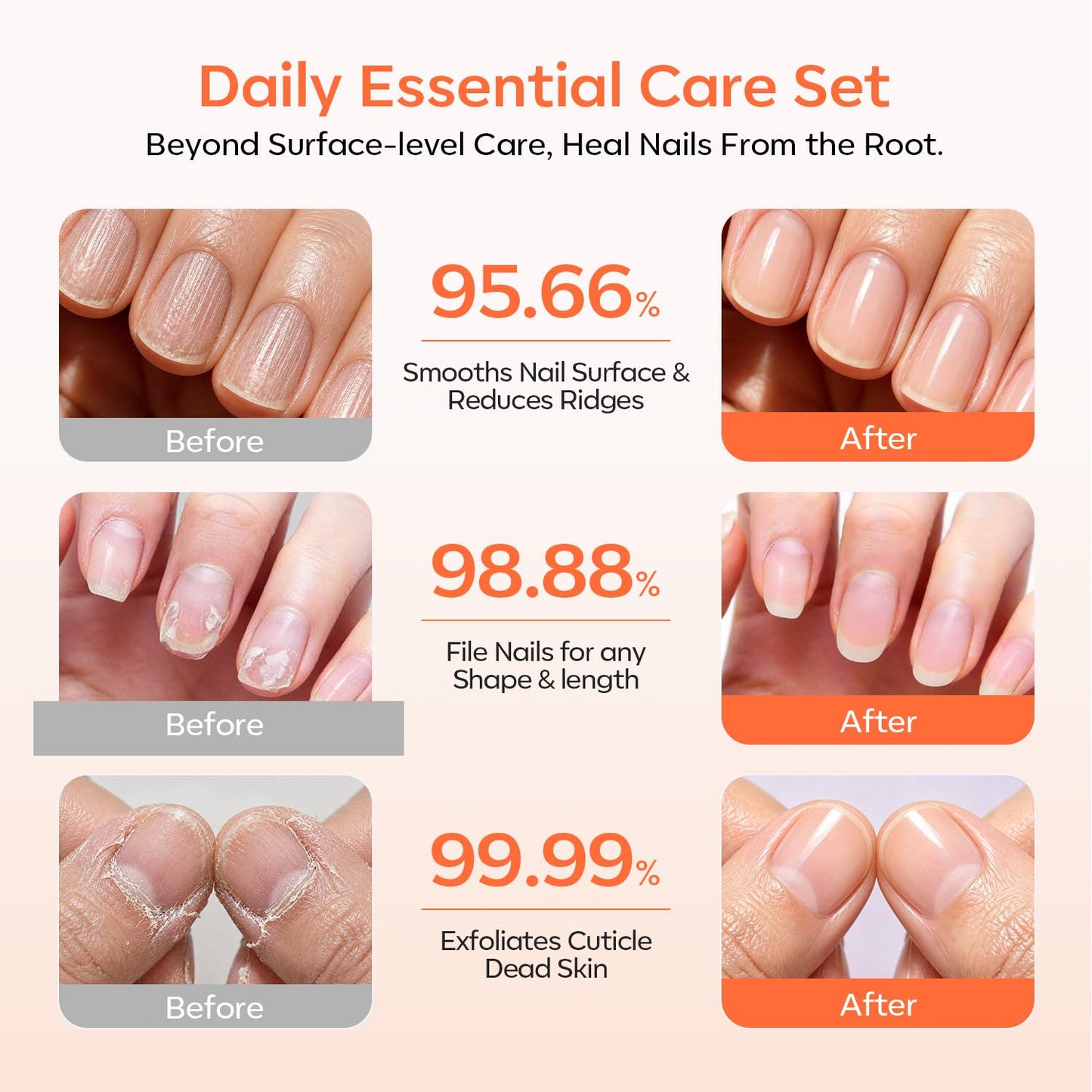 Modelones Cuticle Remover Kit Cuticle Remover Liquid & Cuticle Oil Pen Nail Kit w/Cuticle Trimmer Nail Stuff & File Cuticle Pusher & Nippers Manicure Kit for Women Nail Tools Manicure Set Nail Care
