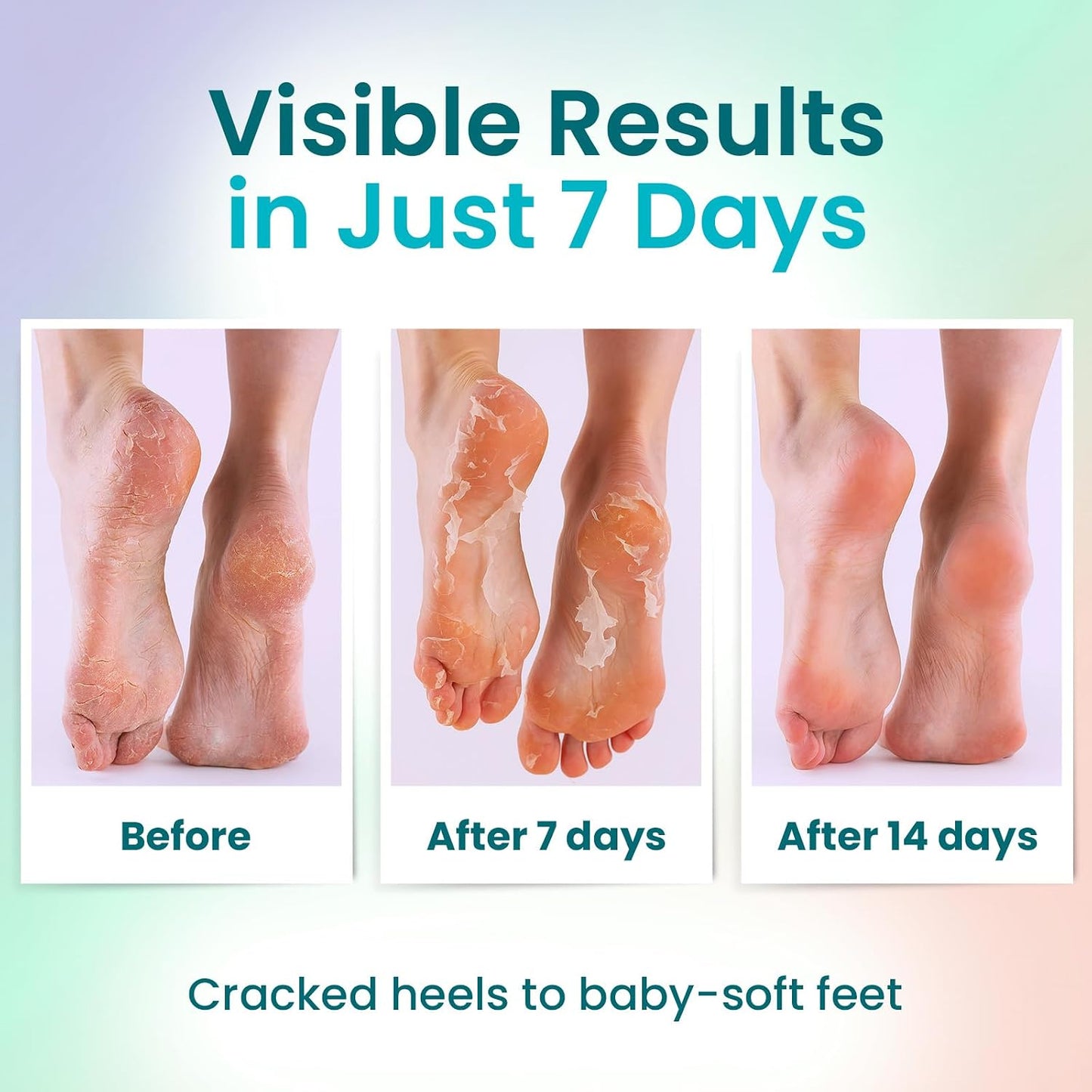 BLOOMORA Foot Peeling Mask (6 pairs) Exfoliating Foot Mask for Dry Cracked Feet with Lavender & Shea Butter, Dead Skin & Callus Remover for Feet, Exfoliating Socks for Women & Men, One Size Fits Most