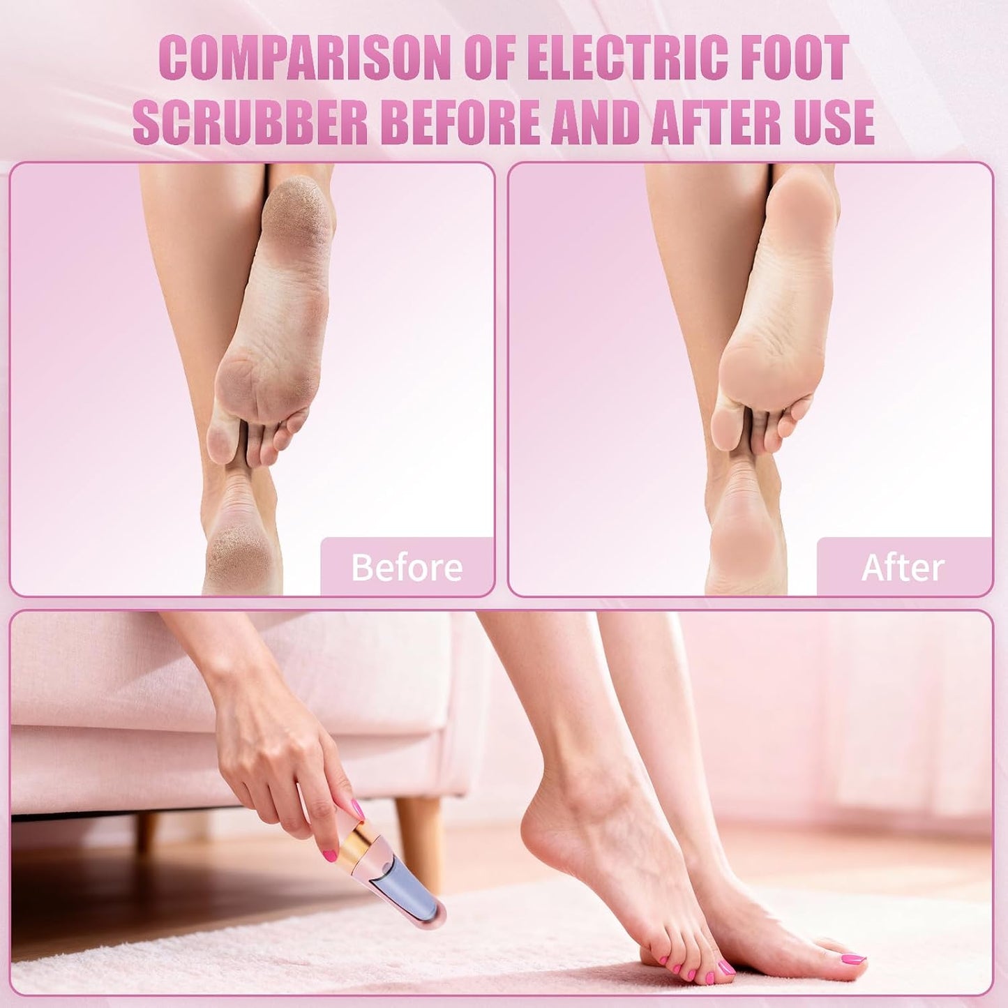 Pedicure Tool, Foot Callus Remover, Electric Pedicure Set, Foot Care, Removes Rough Dead Skin on The Feet, Making Your Feet Smooth. (Pink)