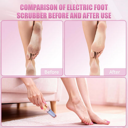 Pedicure Tool, Foot Callus Remover, Electric Pedicure Set, Foot Care, Removes Rough Dead Skin on The Feet, Making Your Feet Smooth. (Pink)