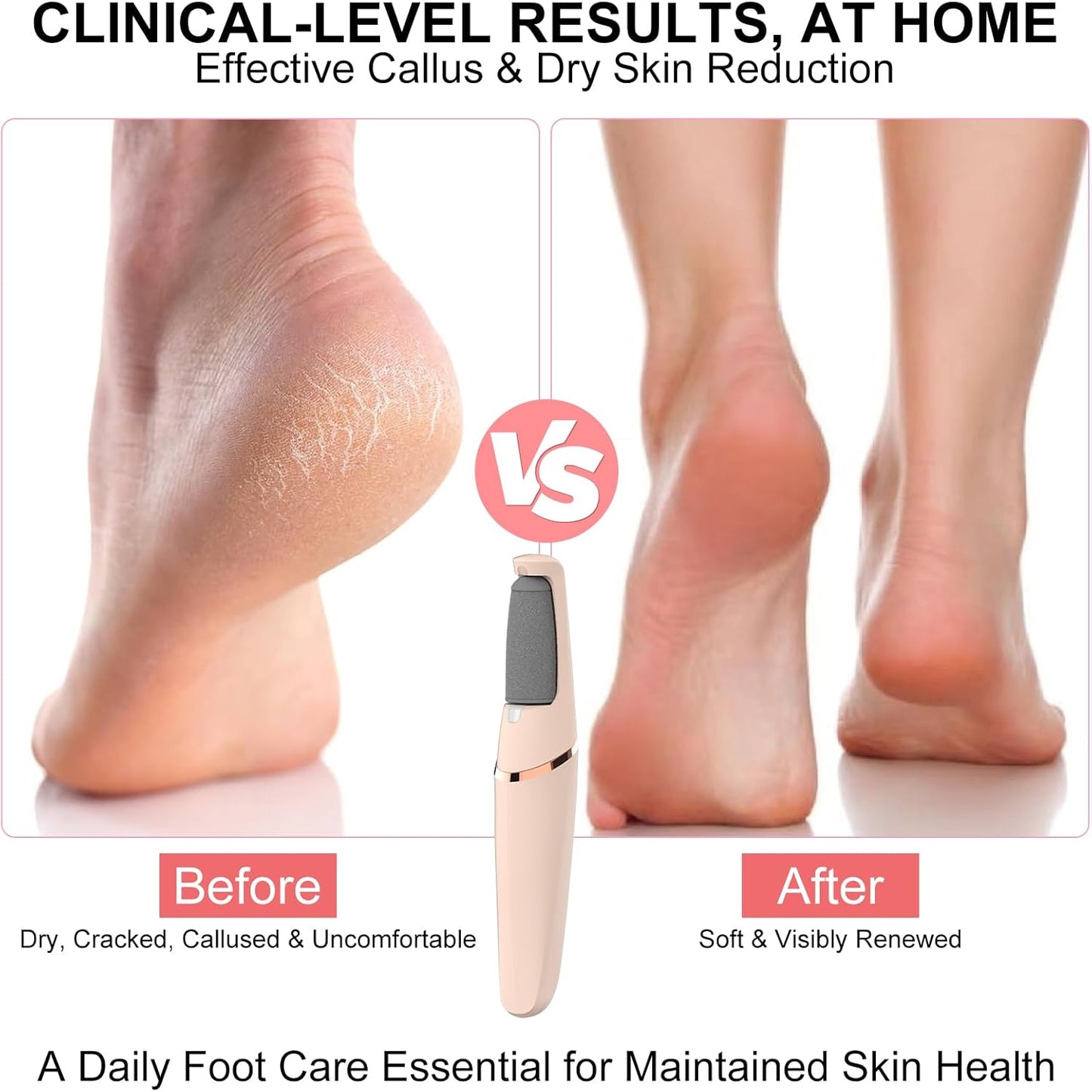 Electric Foot File, Callus Remover for Feet - Rechargeable Pedicure Tool, 2 Speeds 1700/2000 RPM & 2 Heads for Dry & Dead Cracked Skin, Cordless Waterproof Hard Skin Removal, Home Pedicure Gift