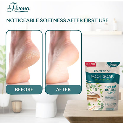 Fivona Tea Tree Foot Soak Blend 14.1 oz - Epsom Salt with Essential Oils for Healthy Toenails, Soothing Relief, Callus Softening - Pedicure Therapy for Soft, Rejuvenated Feet