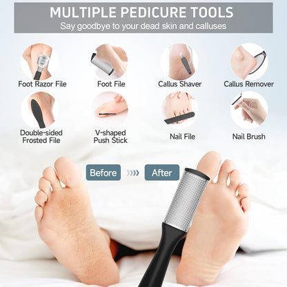 AdamPark Electric Callus Remover for Feet, Rechargeable Portable Electronic Foot Callus Remover 2-in-1 Wet/Dry Foot Scrubber Electric Toot File for Hard Cracked Dry Dead Skin（Pink）