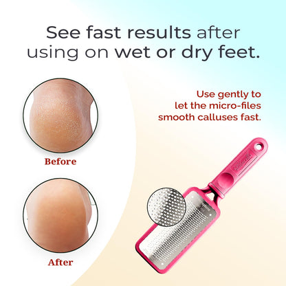 Microplane Colossal Foot File Scraper - The Original Stainless Steel Foot Rasp, Dead Skin/Callus Remover for Feet, Gentle Foot Scrubber, Pedicure Tools for Salon-Quality Foot Care, Black