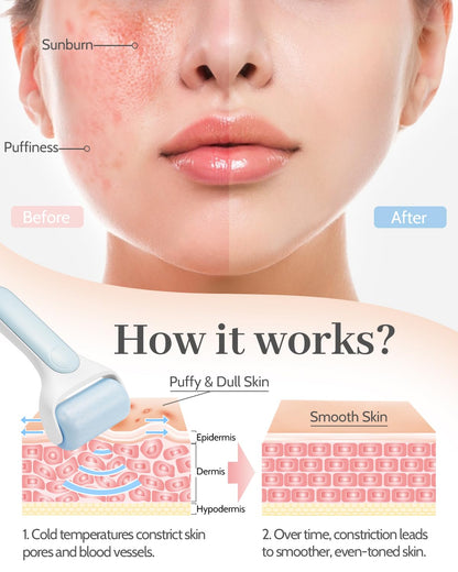 MORGLES Ice Roller for Face, Premium Facial Roller for Puffiness, Dark Circles and Lymphatic Drainage, Cold Face Roller for Women Self Care with Carry Case