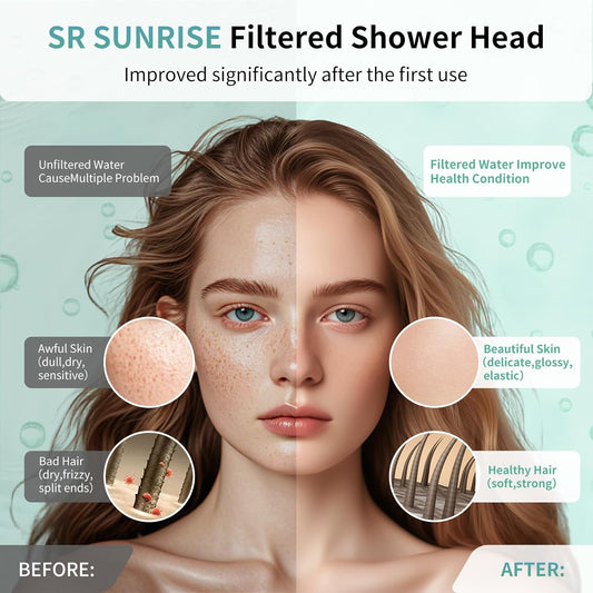 SR SUN RISE Filtered Shower Head with Filters, 20-Stage Shower Head Filter for Hard Water, Fixed Showerhead with Easy-Replace Cartridge to Remove Chlorine & Heavy Metals (7-Inch, Chrome)
