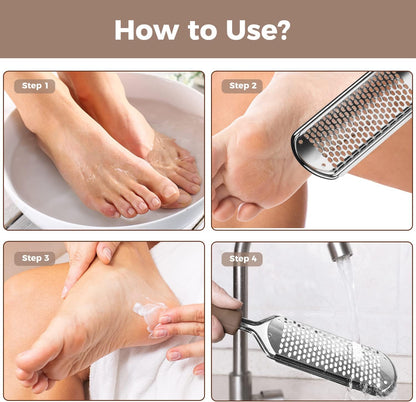 Foot File Foot Scrubber Pedicure - Callus Remover for Feet Easkep Professional Grater Rasp Foot Scraper Corns Callous Removers Cracked Dead Skin Remover for Dry and Wet Feet (Golden)
