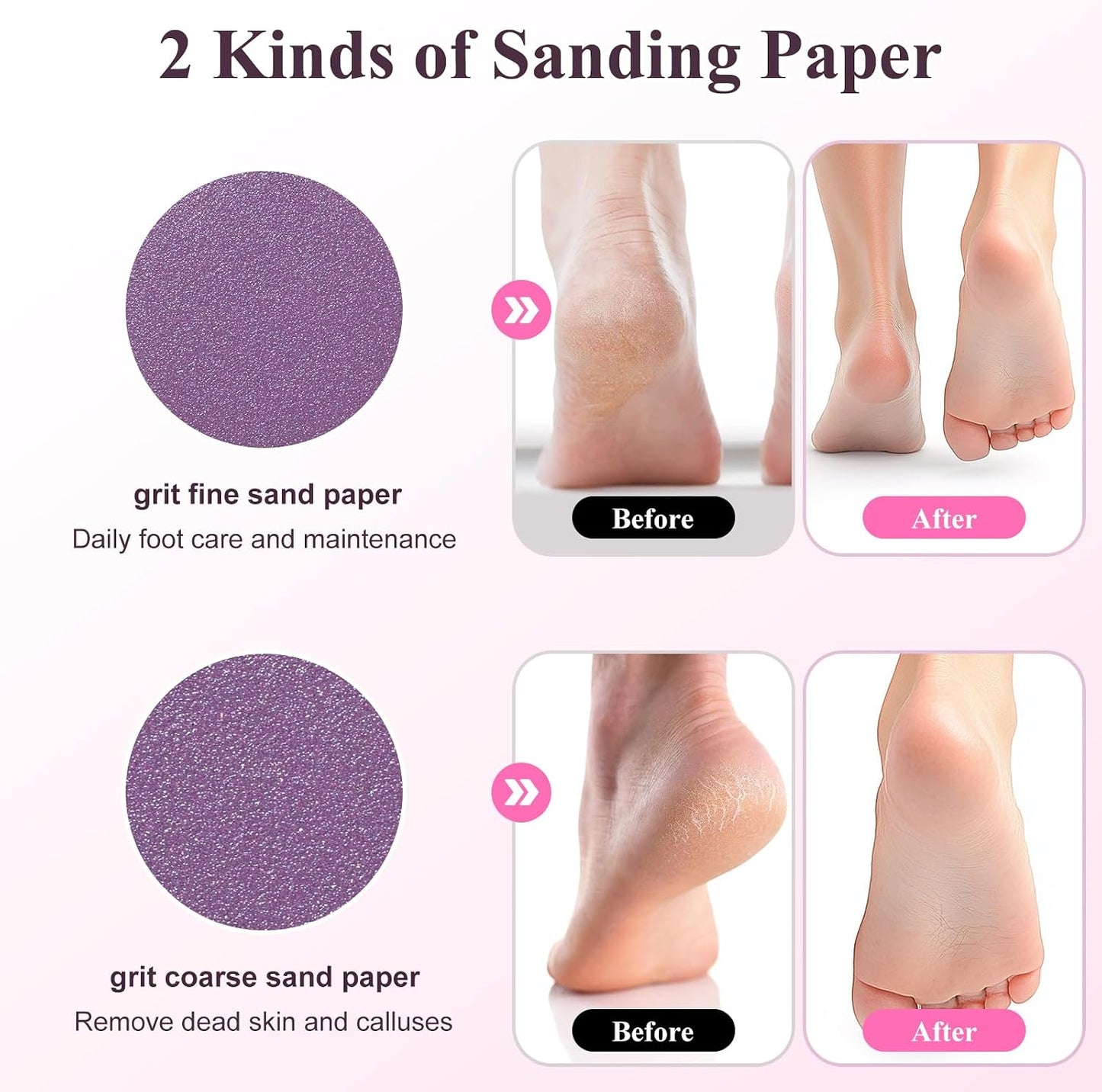 Electric Foot Callus Remover Rechargeable Foot File for Dead Skin | 3 Speeds Callus Remover for Feet, Waterproof Foot Care Pedicure Kit with Foot Cream, Ideal Gift for Men and Women