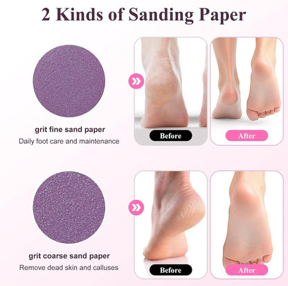 Electric Foot Callus Remover Rechargeable Foot File for Dead Skin | 3 Speeds Callus Remover for Feet, Waterproof Foot Care Pedicure Kit with Foot Cream, Ideal Gift for Men and Women