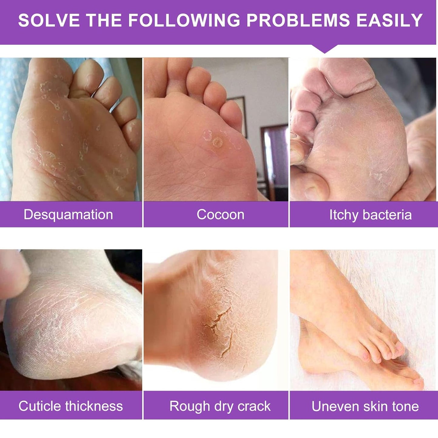 ALIVER Foot Peeling Mask - 5 Pack, Exfoliating Mask Make Feet Baby Soft, Foot Mask for Dry Cracked Skin, Peeling Away Dead Skin, Calluses - Lavender