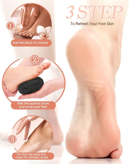 Maryton Foot Pumice Stone for Feet Hard Skin Callus Remover and Scrubber (Pack of 4) (Blue)