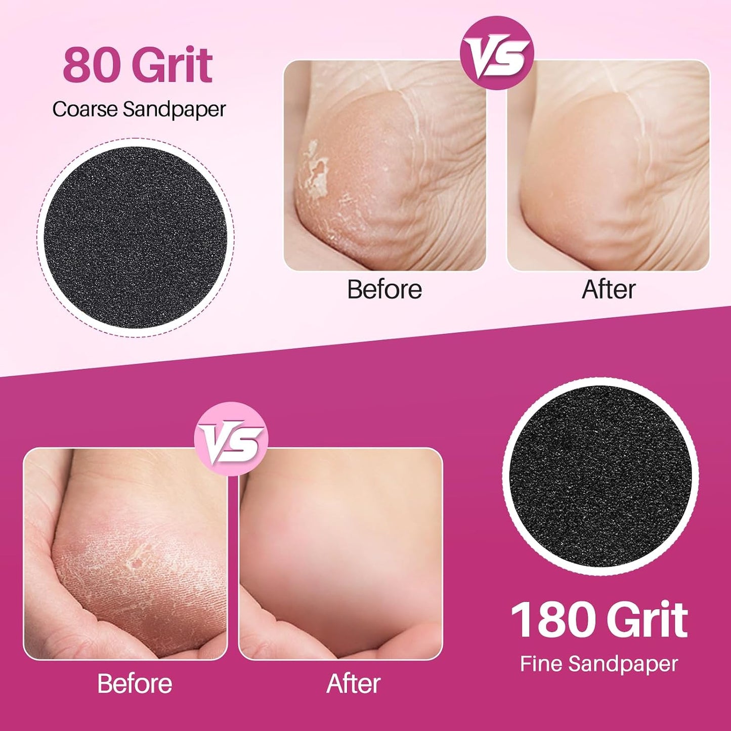 LIONVISON Electric Foot Callus Remover: Adjustable Speed Foot File for Cracked Heels - Working Women's Summer Pedicure Tool with 60pcs Sandpaper Discs - Dead Skin Remover for Dry Feet at-Home