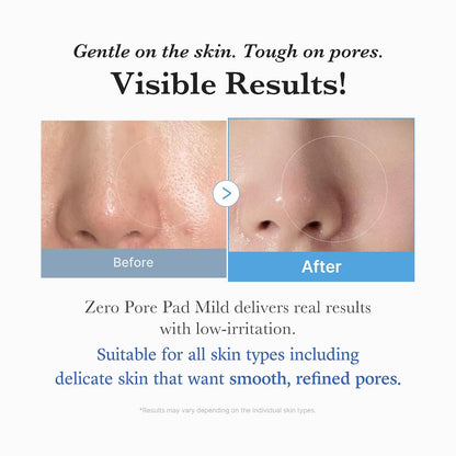medicube Toner Pads Zero Pore Pad 2.0 | Dual-Textured Facial Pad for Exfoliation and Pore Care with 4.5% AHA Lactic Acid, 0.45% BHA Salicylic Acid | Ideal for All, Korean Skin Care, 70 Pads (1 Pack)