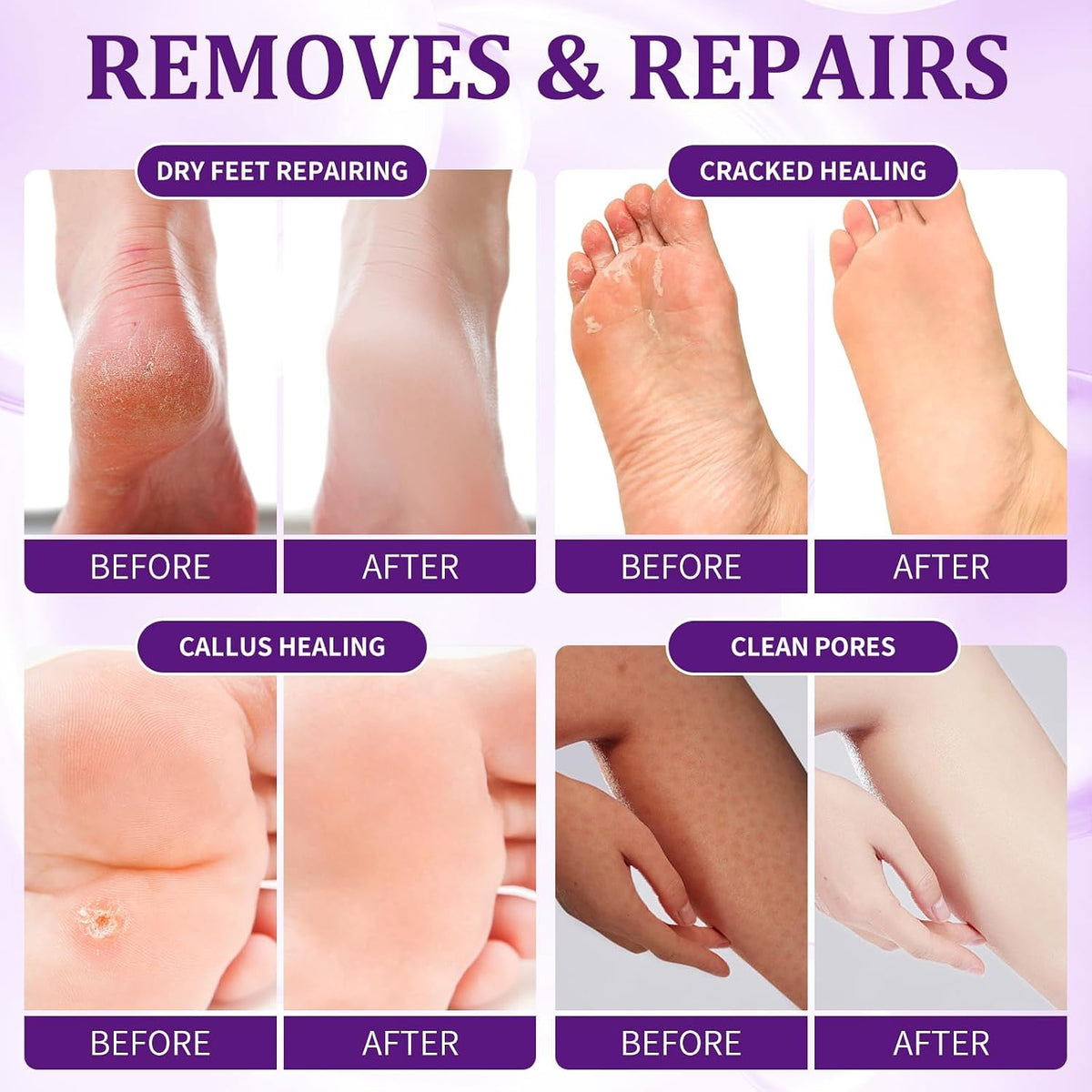 Pedicure Kit Foot Soak Set: Bubble Salt, Sugar Scrub, Massage Mask, Massage Lotion in a Box, 4 Step Foot Spa Kit for Dry Feet, Softens Calluses, Tired Feet（ Lavender) - Colors B