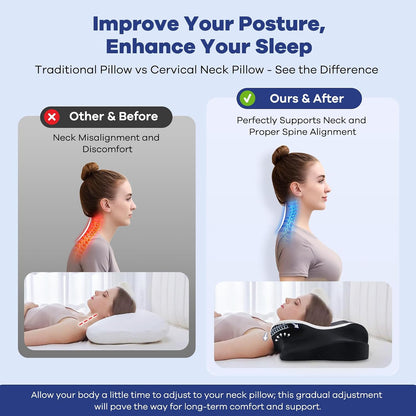 DONAMA Cervical Pillow for Neck and Shoulder,Contour Memory Foam Pillow,Ergonomic Neck Support Pillow for Side Back Stomach Sleepers with Pillowcase