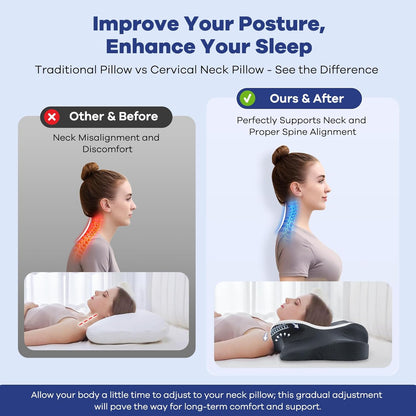 DONAMA Cervical Pillow for Neck and Shoulder,Contour Memory Foam Pillow,Ergonomic Neck Support Pillow for Side Back Stomach Sleepers with Pillowcase