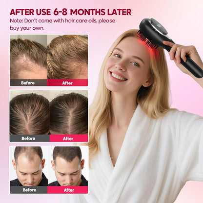 Morfone Upgrade 3 in 1 Electric Scalp Massager Brushes, Hair Oil Applicator, IPX7 Waterproof Scalp Massager Comb, Cordless & Portable Adjustable Modes for Men Women