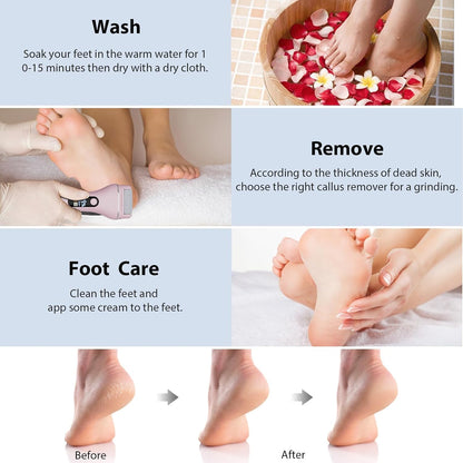 AdamPark Electric Callus Remover for Feet, Rechargeable Portable Electronic Foot Callus Remover 2-in-1 Wet/Dry Foot Scrubber Electric Toot File for Hard Cracked Dry Dead Skin（Pink）