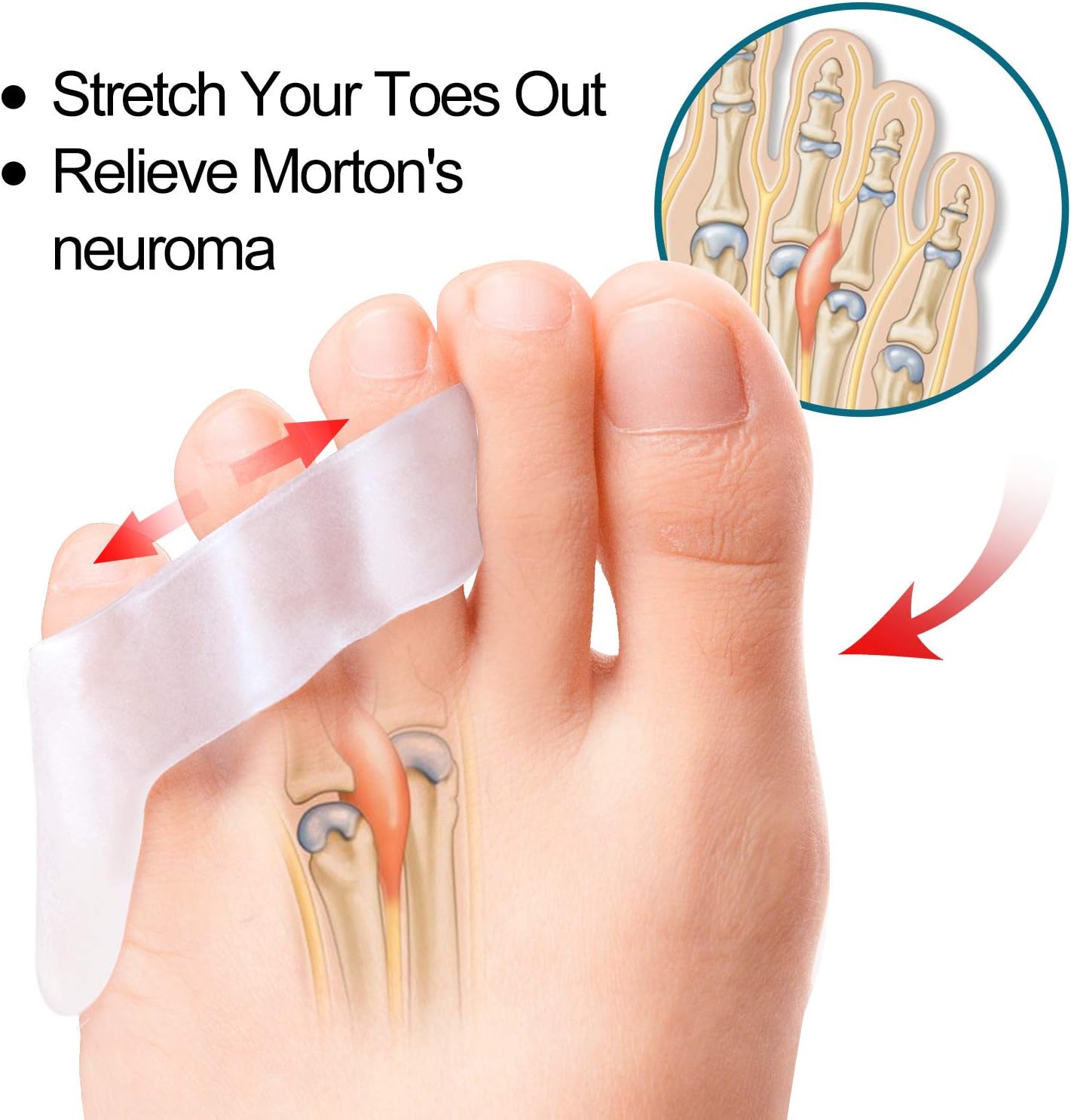 Povihome 10 Pack Pinky Toe Separator and Protectors for Overlapping Toe, Curled Pinky Toes - Spacers for Morton's Neuroma Pain Relief