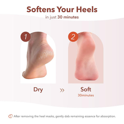 Purederm Exfoliating Foot Peeling Mask & Foot Peel for Dry Cracked Heels (1 Pack) – Dead Skin & Callus Remover for Feet, Rough Skin Care for Baby Soft Feet