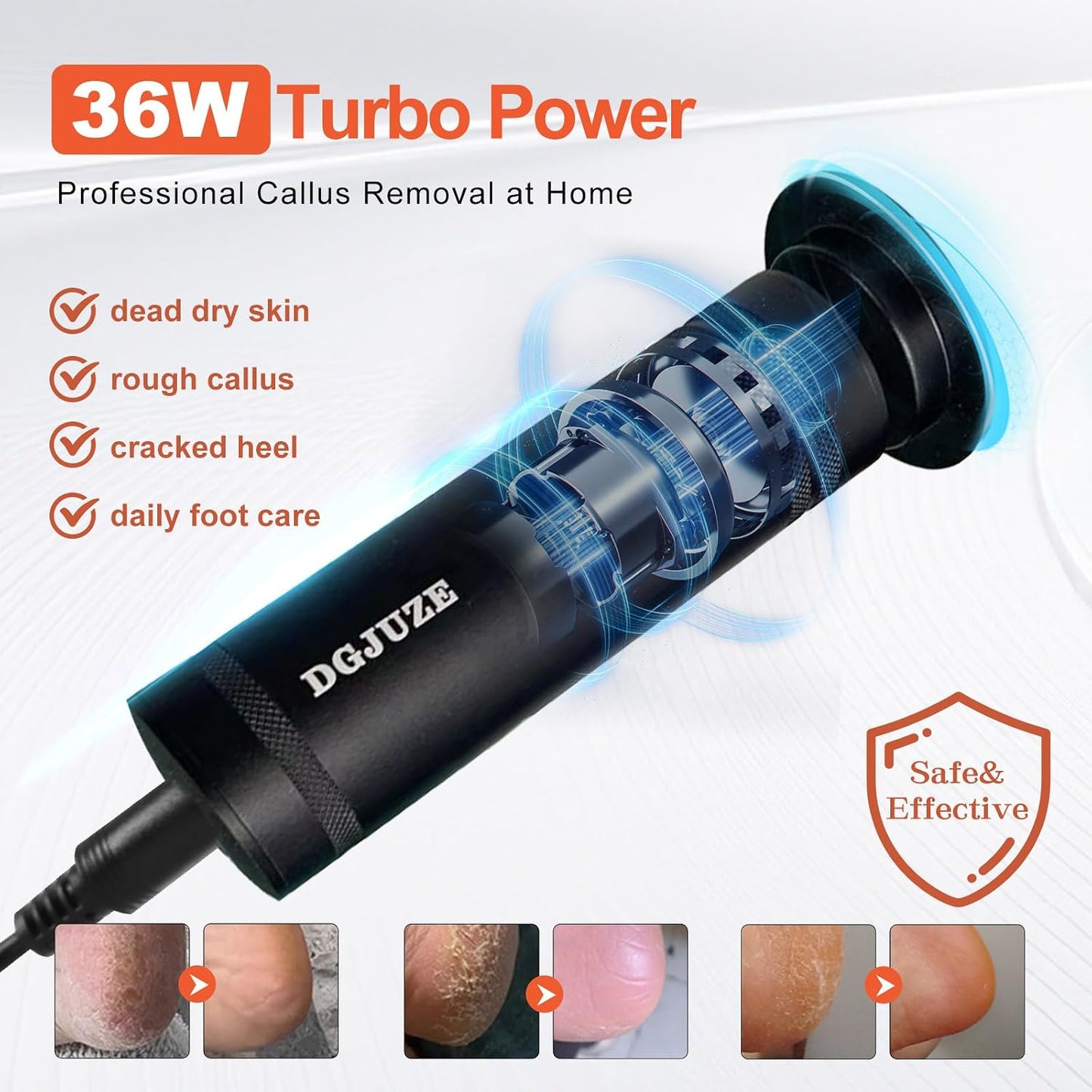 Electric Foot Callus Remover 36W, 1200RPM Heavy Duty Metal Grinder