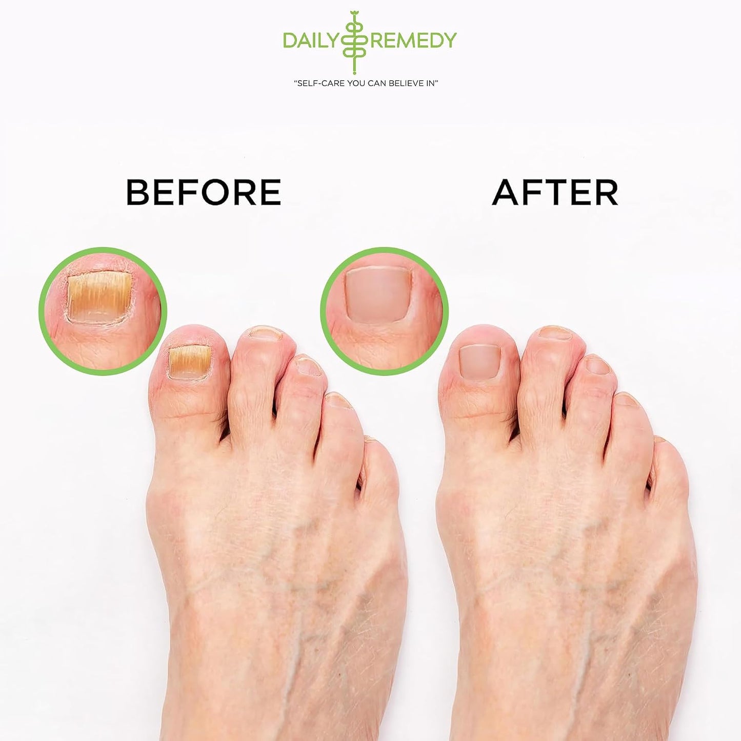 Muscle Relief Foot Soak with Epsom Salt, Made in USA, Soothe Tired Feet, Softens Calluses and Helps Athletes Foot 1lbs