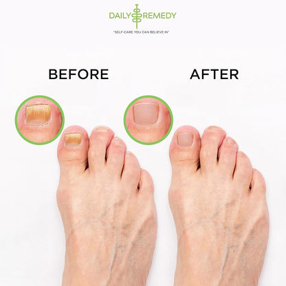 Muscle Relief Foot Soak with Epsom Salt, Made in USA, Soothe Tired Feet, Softens Calluses and Helps Athletes Foot 1lbs