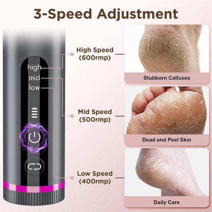 Electric Foot Callus Remover with 2600mAh Battery, 60Pcs Sandpaper Discs