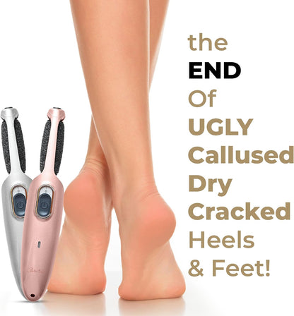 Powerful Electric Callus Remover Wand – Rechargeable Foot File, Grinder & Scrubber - Removes Dead, Hard Skin & Calluses – Best Pedicure Tool for Soft, Smooth Feet for Men & Women (Rose Gold)