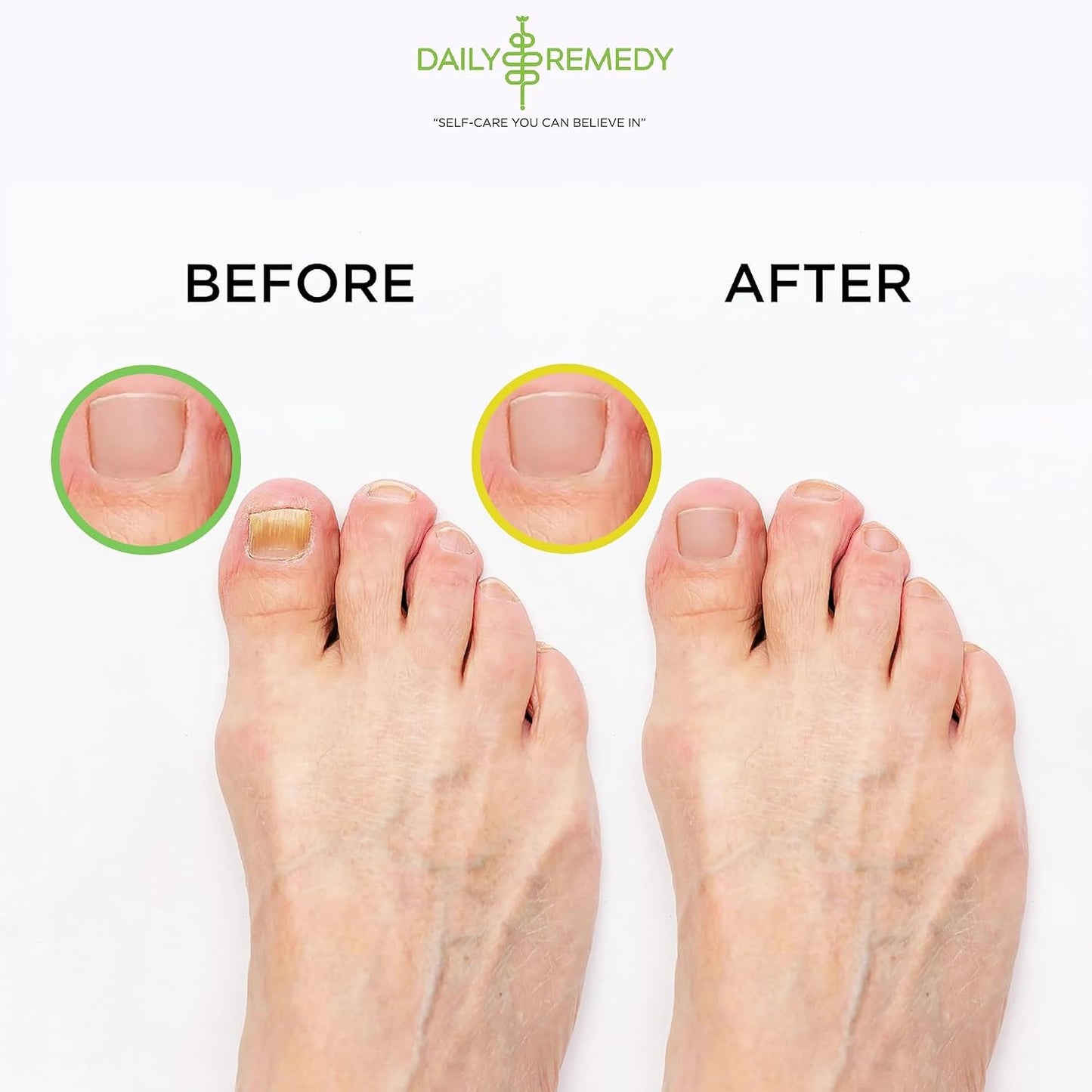 DAILY REMEDY Foot Soak Salts- Variety Pack of 4- Tea Tree Oil, Muscle Relief, Calming Lavender & Citrus Soak- For Foot Pain, Soreness, Athlete’s Foot, Odors, Calluses-Made In USA | Tea Tree Oil