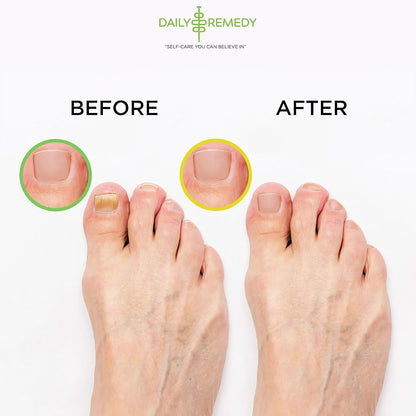 DAILY REMEDY Foot Soak Salts- Variety Pack of 4- Tea Tree Oil, Muscle Relief, Calming Lavender & Citrus Soak- For Foot Pain, Soreness, Athlete’s Foot, Odors, Calluses-Made In USA | Tea Tree Oil